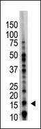 Ubiquitin-conjugating enzyme E2 B antibody, AP11973PU-N, Origene, Western Blot image 