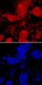 PR/SET Domain 14 antibody, MAB8097, R&D Systems, Immunocytochemistry image 