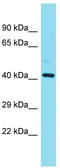 Family With Sequence Similarity 181 Member B antibody, TA335360, Origene, Western Blot image 