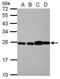 Ribosomal Protein L29 antibody, GTX101833, GeneTex, Western Blot image 