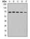 Dihydrolipoamide S-Acetyltransferase antibody, orb341024, Biorbyt, Western Blot image 