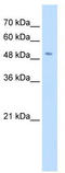 Synaptic vesicular amine transporter antibody, TA334042, Origene, Western Blot image 