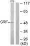 Serum Response Factor antibody, TA311633, Origene, Western Blot image 