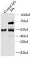 Plasminogen Activator, Tissue Type antibody, FNab08881, FineTest, Immunoprecipitation image 