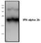 Interferon alpha/beta receptor 2 antibody, TA319105, Origene, Western Blot image 