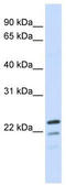 Receptor Accessory Protein 1 antibody, TA338627, Origene, Western Blot image 
