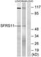 Serine And Arginine Rich Splicing Factor 11 antibody, TA314891, Origene, Western Blot image 