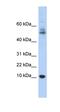 Myotrophin antibody, orb325792, Biorbyt, Western Blot image 