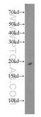 Ribosomal Protein S10 antibody, 14894-1-AP, Proteintech Group, Western Blot image 