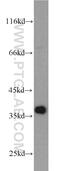 PCNA antibody, 10205-2-AP, Proteintech Group, Western Blot image 