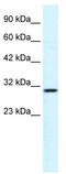 Zinc Finger HIT-Type Containing 6 antibody, TA337227, Origene, Western Blot image 