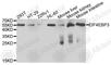 Eukaryotic Translation Initiation Factor 4E Binding Protein 3 antibody, A9913, ABclonal Technology, Western Blot image 