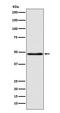 Serpin Family A Member 9 antibody, M09606, Boster Biological Technology, Western Blot image 