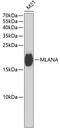 MART1 antibody, A02033-1, Boster Biological Technology, Western Blot image 