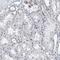 Chromosome 22 Open Reading Frame 42 antibody, PA5-54015, Invitrogen Antibodies, Immunohistochemistry paraffin image 