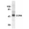 C-C chemokine receptor type 8 antibody, AHP567, Bio-Rad (formerly AbD Serotec) , Western Blot image 