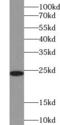 CD3d Molecule antibody, FNab01457, FineTest, Western Blot image 