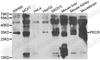 Peroxisomal trans-2-enoyl-CoA reductase antibody, A7206, ABclonal Technology, Western Blot image 