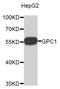 Glypican-1 antibody, STJ23837, St John