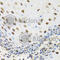 TATA-binding protein-associated factor 2N antibody, A8465, ABclonal Technology, Immunohistochemistry paraffin image 