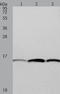 Profilin I antibody, TA322682, Origene, Western Blot image 