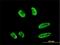 Ring Finger Protein 151 antibody, H00146310-M02, Novus Biologicals, Immunofluorescence image 