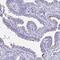 Chromosome 4 Open Reading Frame 17 antibody, PA5-63878, Invitrogen Antibodies, Immunohistochemistry frozen image 