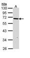 Bifunctional arginine demethylase and lysyl-hydroxylase JMJD6 antibody, TA308580, Origene, Western Blot image 