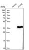 Sideroflexin 2 antibody, PA5-55435, Invitrogen Antibodies, Western Blot image 