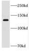 DNA Helicase B antibody, FNab03821, FineTest, Western Blot image 