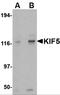 KIF5A antibody, 4291, ProSci Inc, Western Blot image 