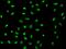 PPARG Coactivator 1 Alpha antibody, 207119-T02, Sino Biological, Immunohistochemistry paraffin image 