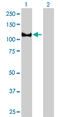 Erythrocyte Membrane Protein Band 4.1 antibody, LS-C133174, Lifespan Biosciences, Western Blot image 