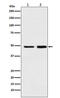 Methionine Adenosyltransferase 2A antibody, M04557, Boster Biological Technology, Western Blot image 