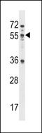 Mex-3 RNA Binding Family Member B antibody, PA5-71968, Invitrogen Antibodies, Western Blot image 