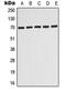 ABCD3 antibody, GTX54937, GeneTex, Western Blot image 