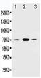 Succinate Dehydrogenase Complex Iron Sulfur Subunit B antibody, LS-C312870, Lifespan Biosciences, Western Blot image 