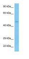 Lysine Methyltransferase 5C antibody, orb325668, Biorbyt, Western Blot image 