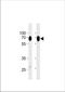 Ecto-5 -nucleotidase antibody, TA324900, Origene, Western Blot image 