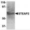 STEAP2 Metalloreductase antibody, MBS151269, MyBioSource, Western Blot image 