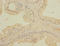 Telomere Repeat Binding Bouquet Formation Protein 1 antibody, A66382-100, Epigentek, Immunohistochemistry paraffin image 
