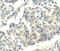 ABL Proto-Oncogene 1, Non-Receptor Tyrosine Kinase antibody, MBS2527076, MyBioSource, Immunohistochemistry frozen image 