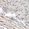 Heterogeneous nuclear ribonucleoprotein M antibody, A6937, ABclonal Technology, Immunohistochemistry paraffin image 