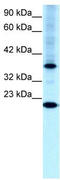 Transcription Factor CP2 Like 1 antibody, TA329694, Origene, Western Blot image 