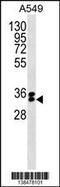 F-Box Protein 44 antibody, 59-868, ProSci, Western Blot image 