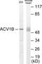 Activin A Receptor Type 1B antibody, EKC1716, Boster Biological Technology, Western Blot image 