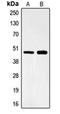 Forkhead Box B2 antibody, orb215427, Biorbyt, Western Blot image 