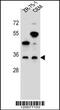 Neuronal membrane glycoprotein M6-b antibody, MBS9206791, MyBioSource, Western Blot image 