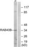 RAB40B, Member RAS Oncogene Family antibody, LS-C120310, Lifespan Biosciences, Western Blot image 