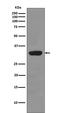 Ribosomal Protein S3 antibody, M01542, Boster Biological Technology, Western Blot image 